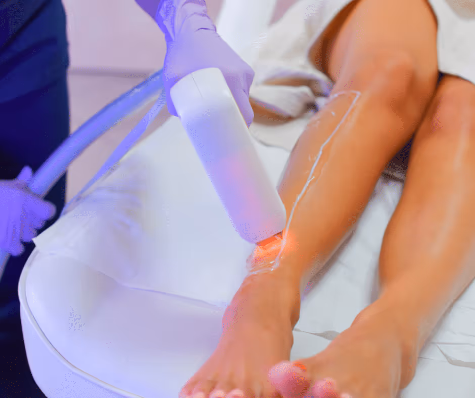 laser hair removal legs toronto