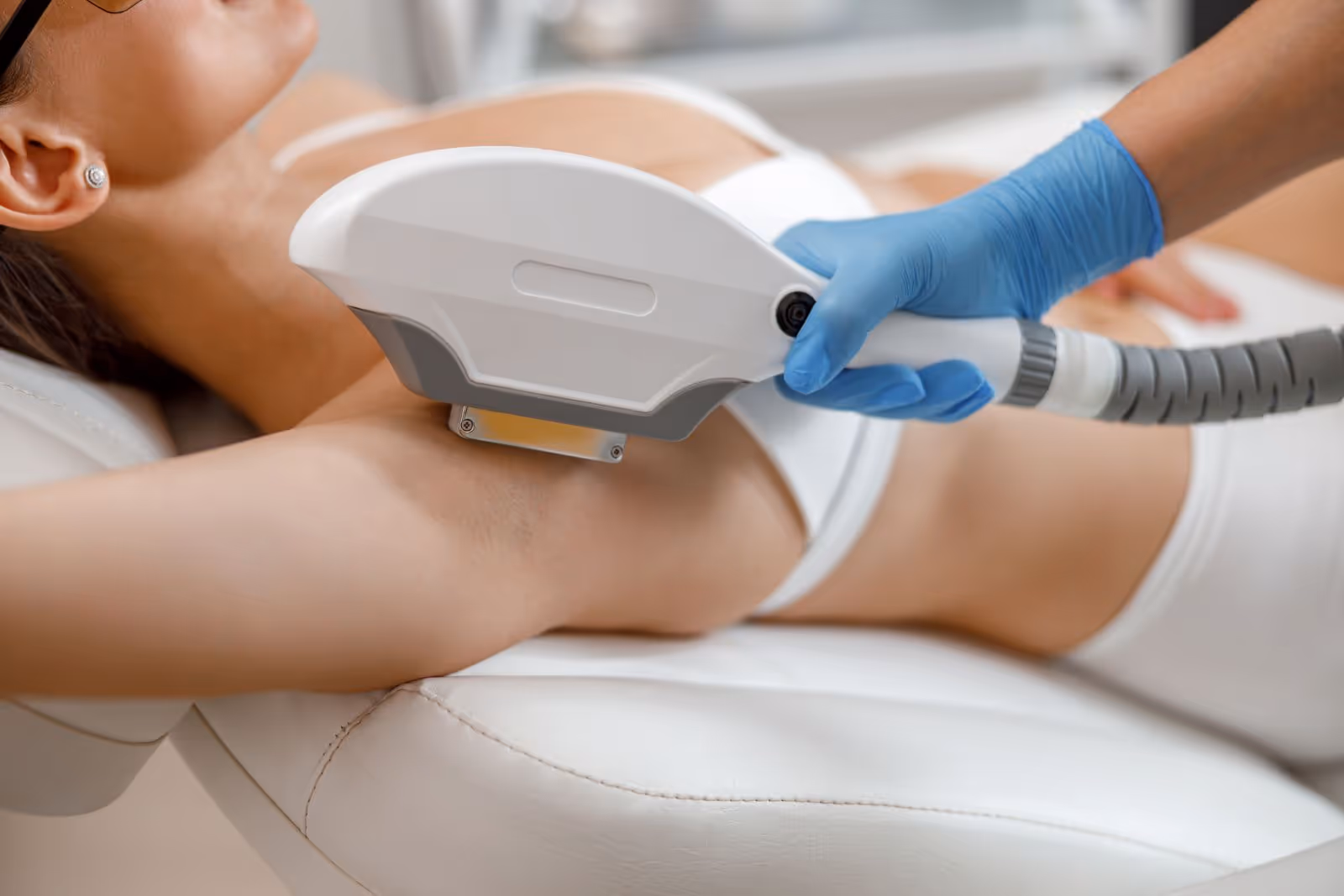 laser hair removal for underarm