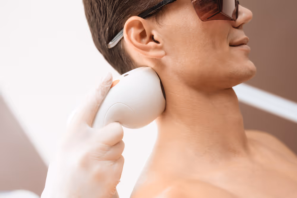 laser hair removal for back of neck