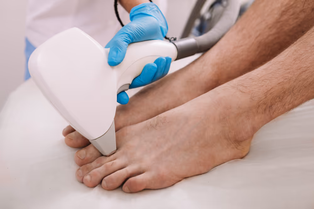 toe laser hair removal for men