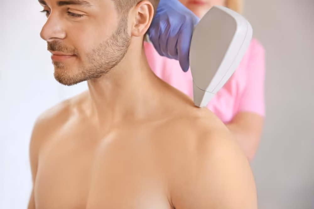 laser hair removal for shoulder