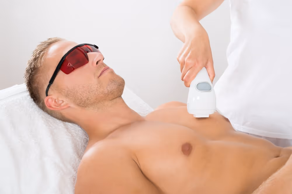chest laser hair removal for men