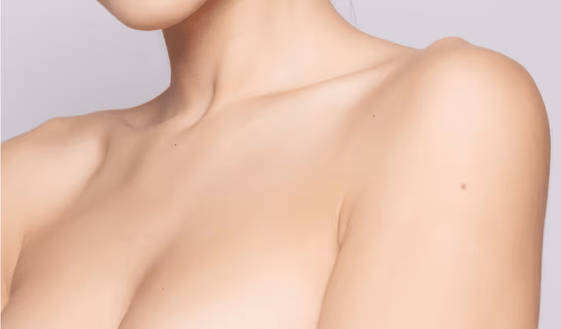 laser hair removal toronto