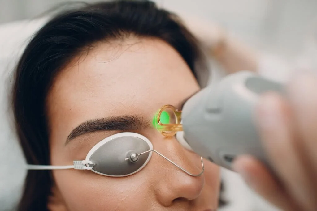 laser hair removal eyebrows toronto