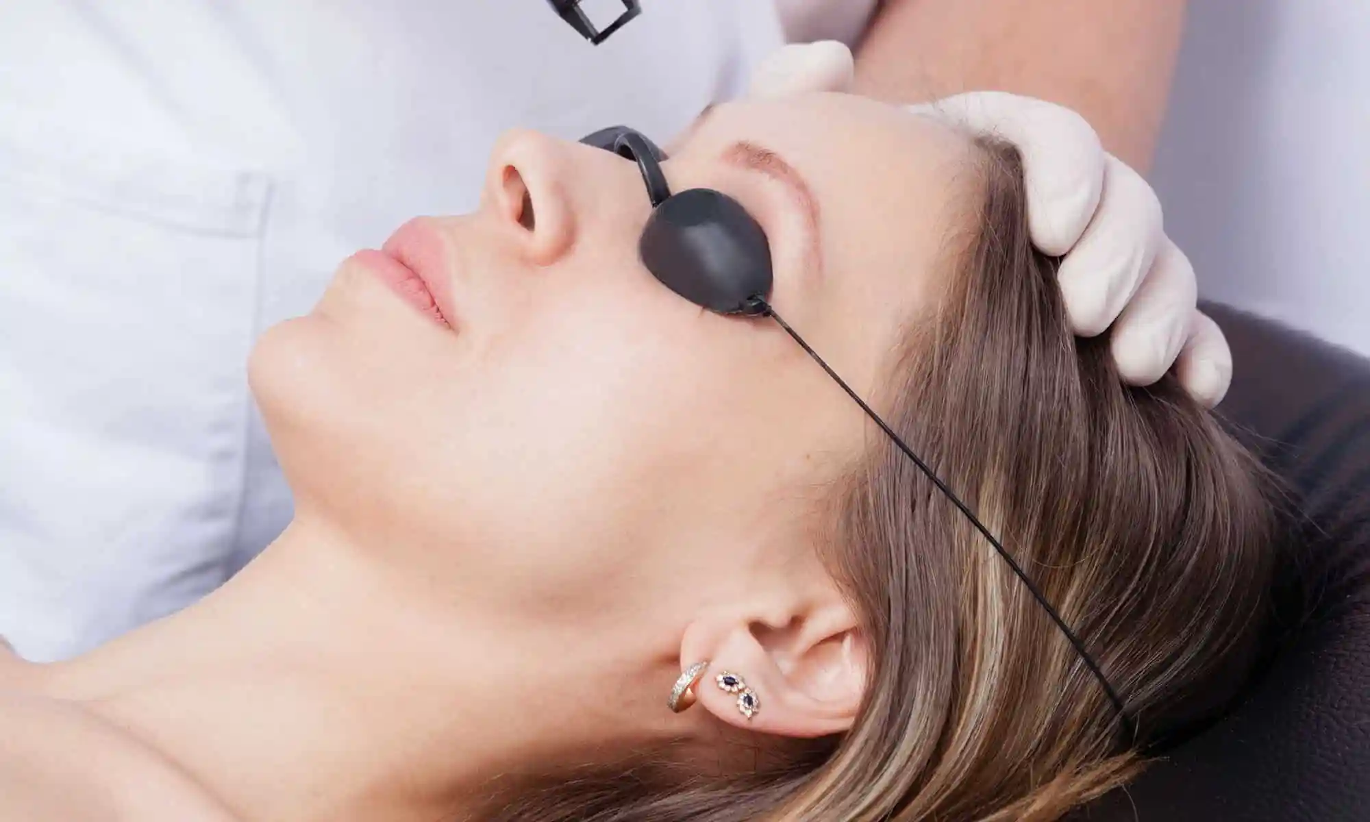 laser hair removal for eyebrows women
