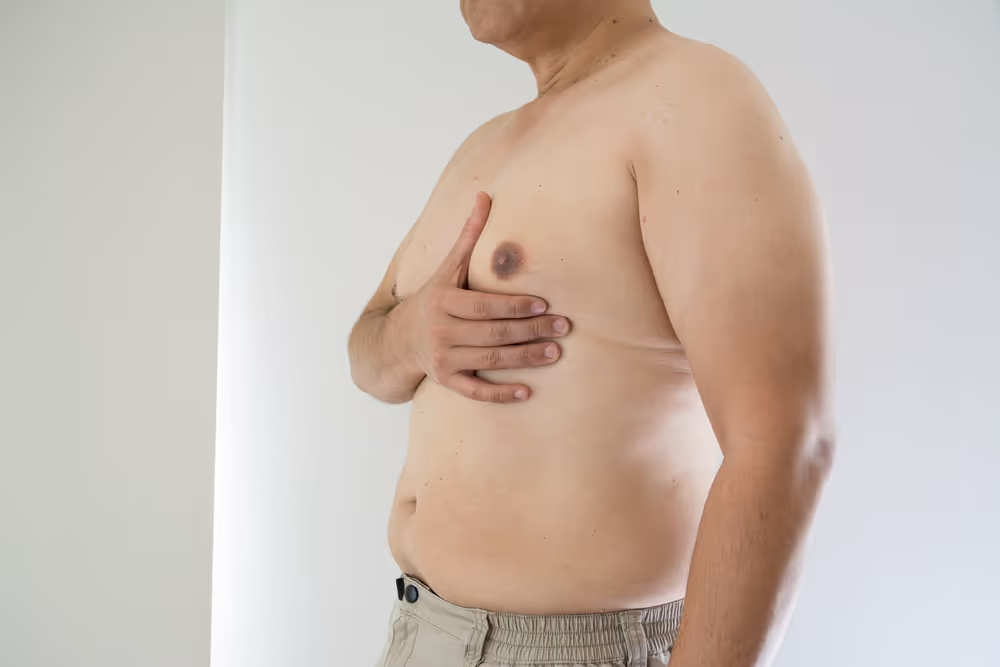 coolsculpting male breast