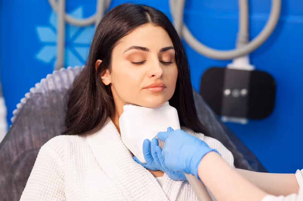 coolsculpting for chin
