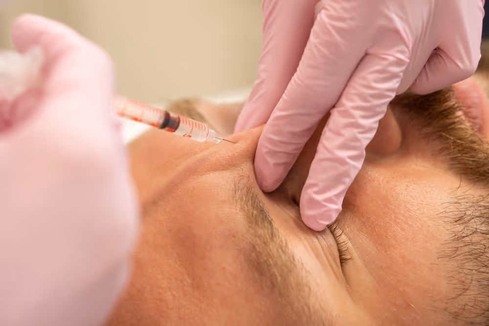 botox for gummy smile