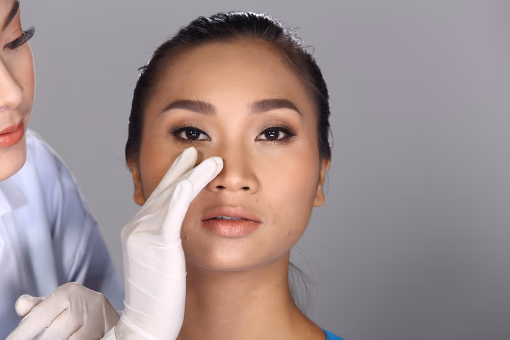 botox for bunny line toronto