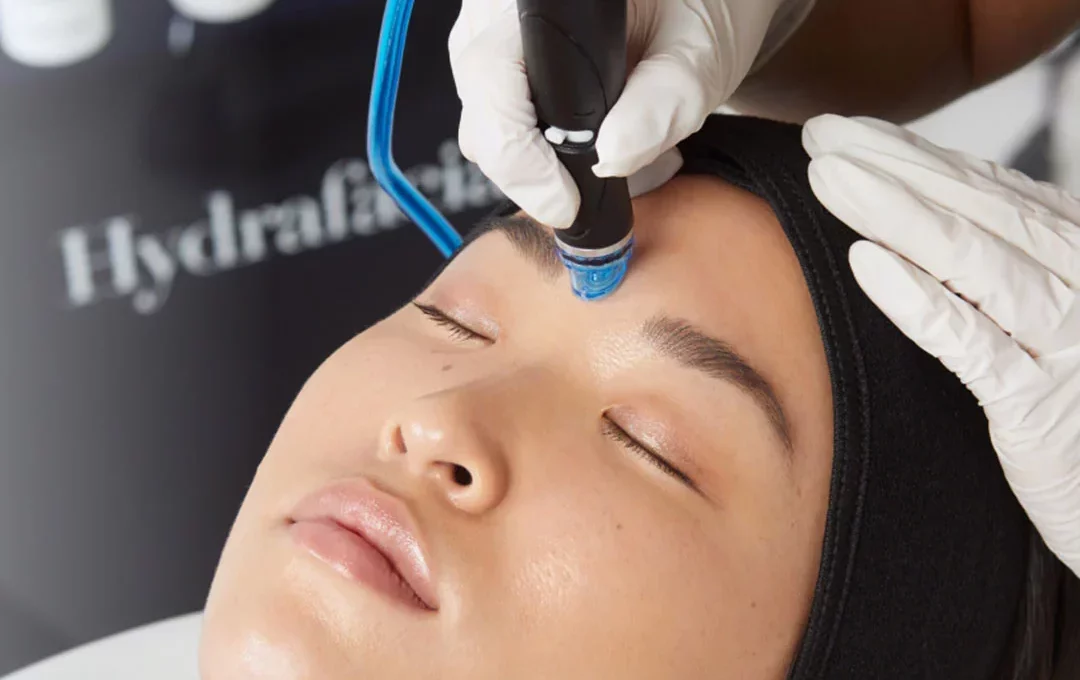 hydrafacial in hamilton