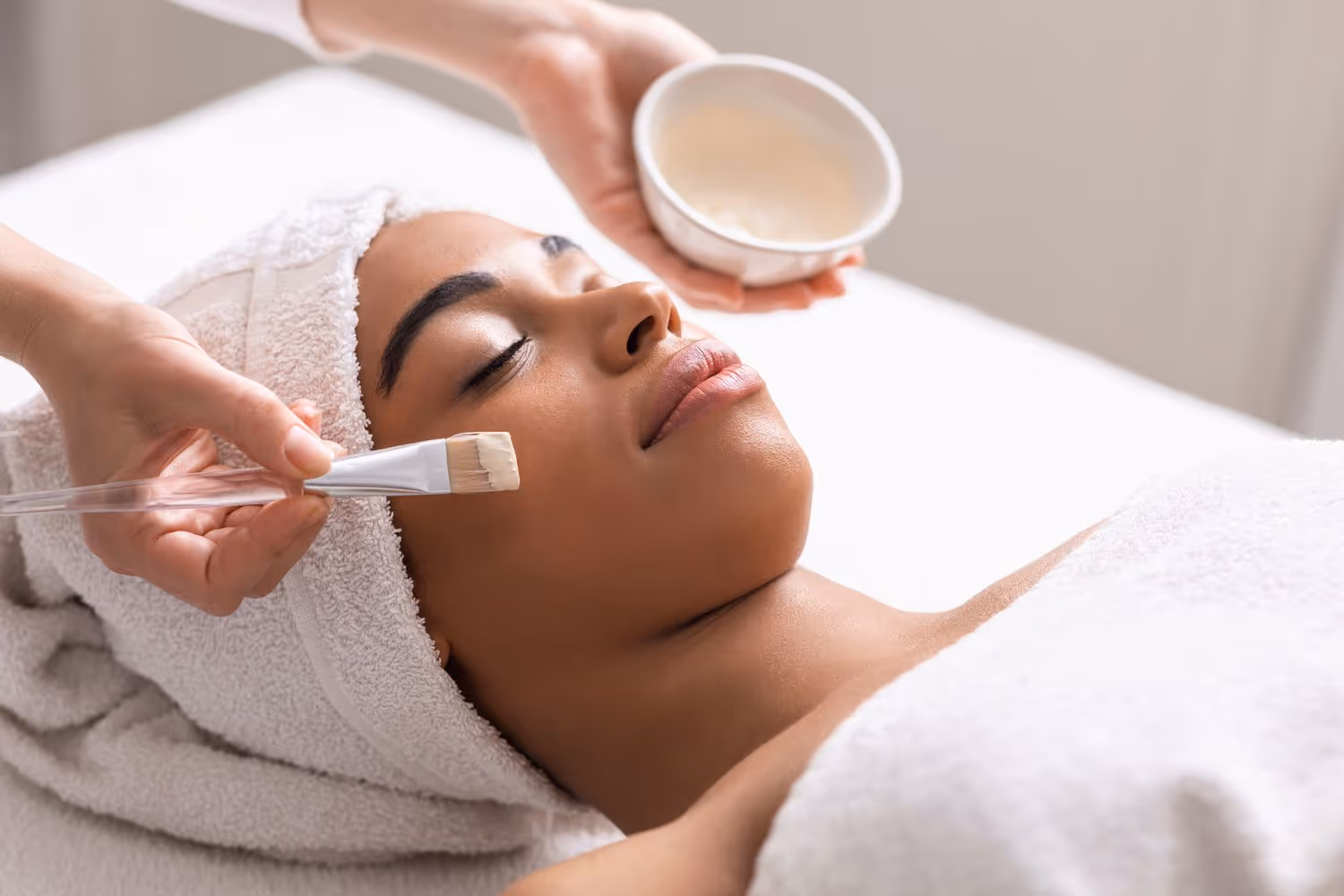 chemical peel service toronto