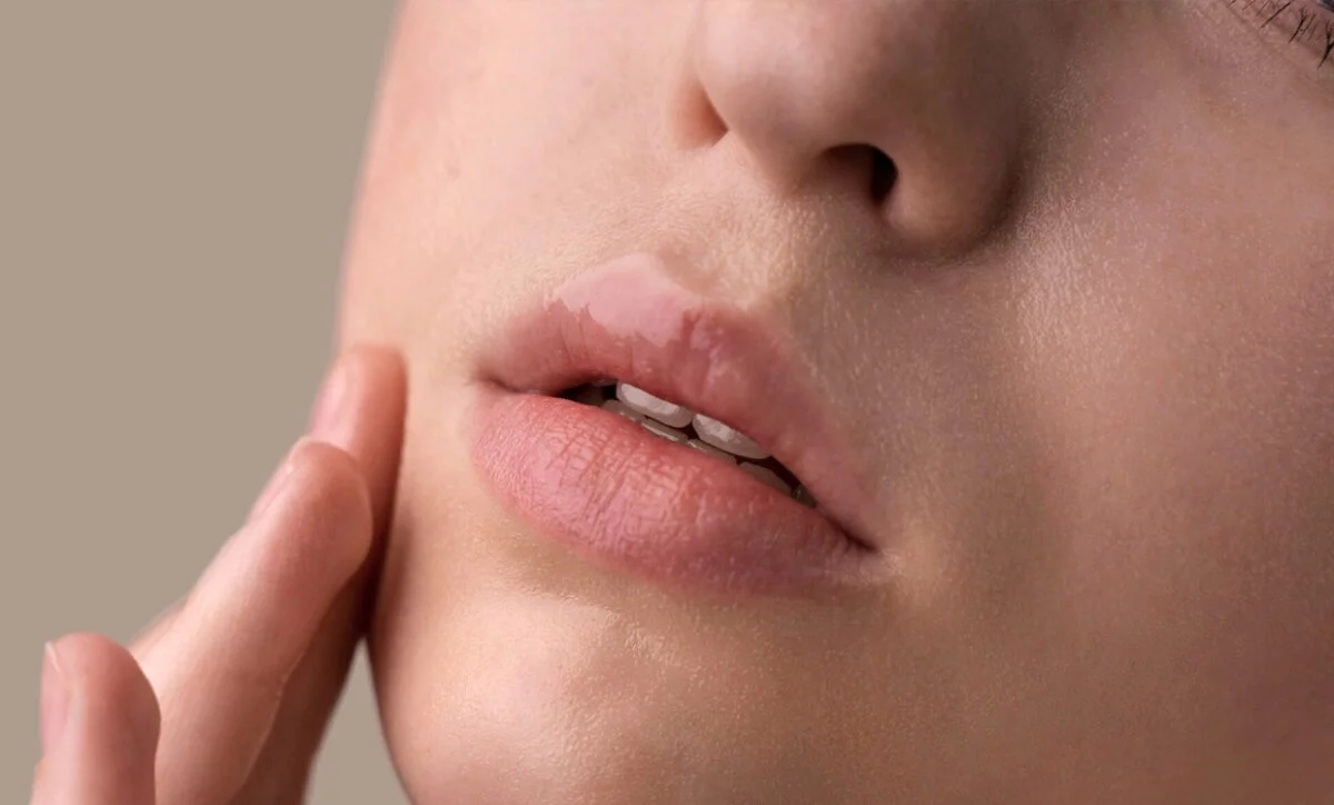 laser hair removal upper lips toronto
