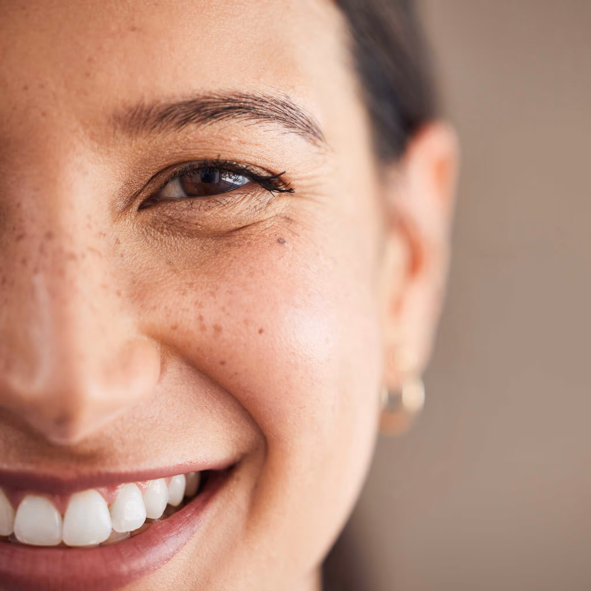 laser hair removal for upper lips