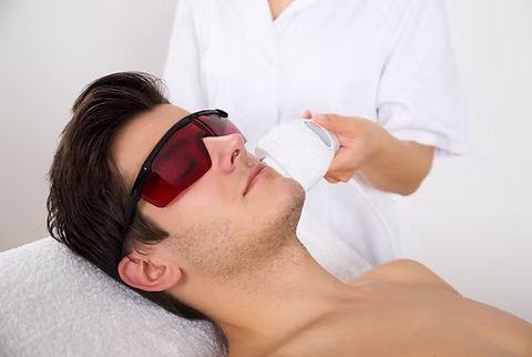 upper lip laser hair removal for men