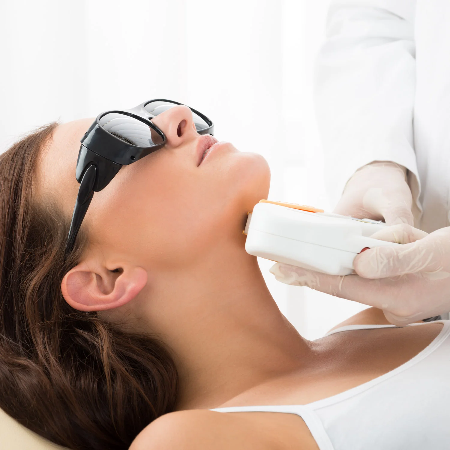 laser hair removal for chin