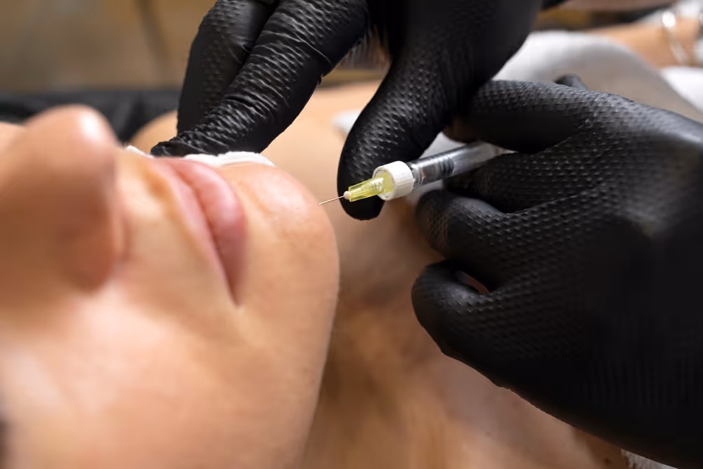 dermal fillers toronto