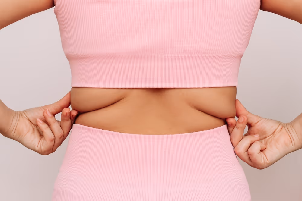 coolsculpting for back