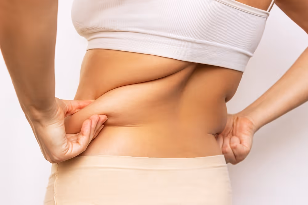 coolsculpting for flanks
