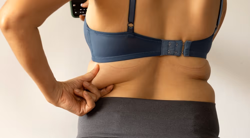 coolsculpting back toronto