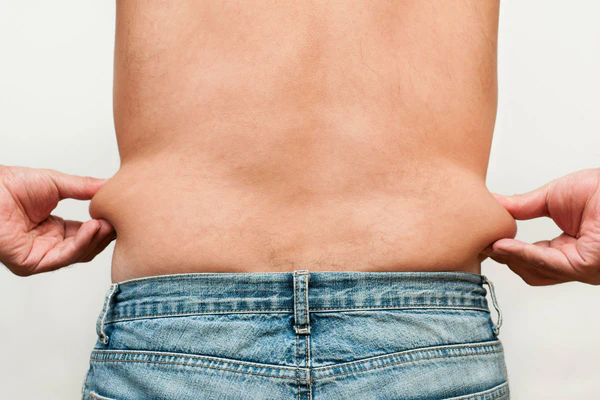 coolsculpting flanks for men