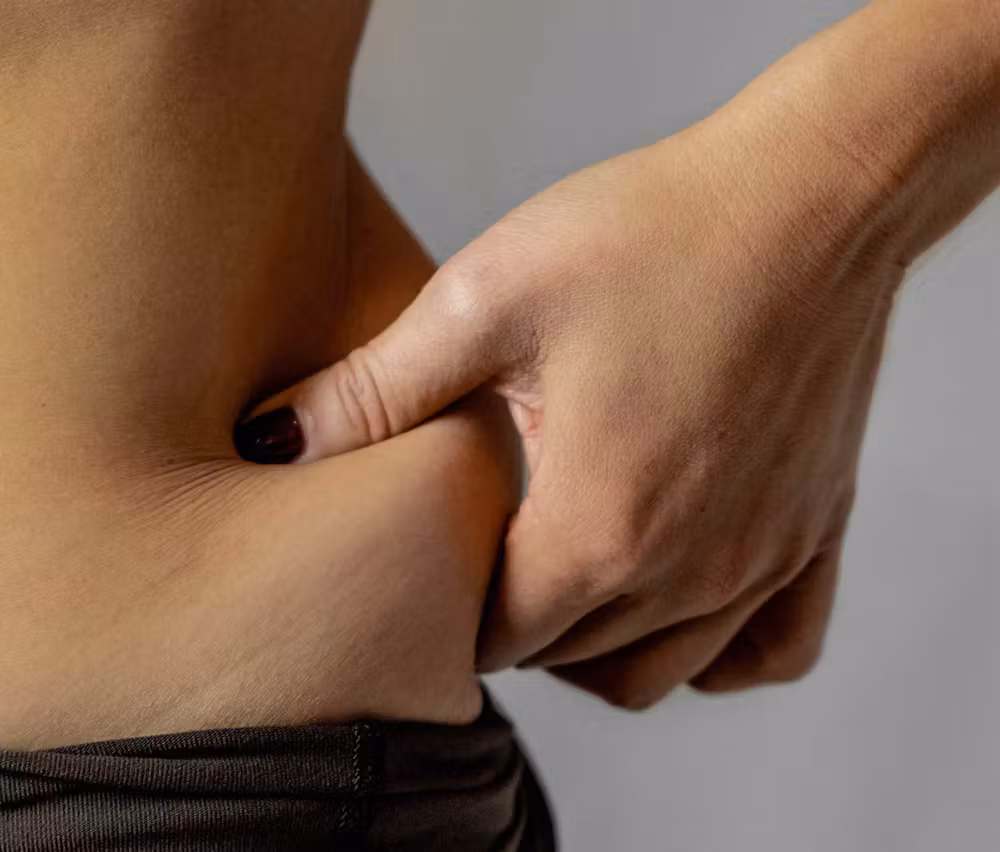 love handles coolsculpting toronto