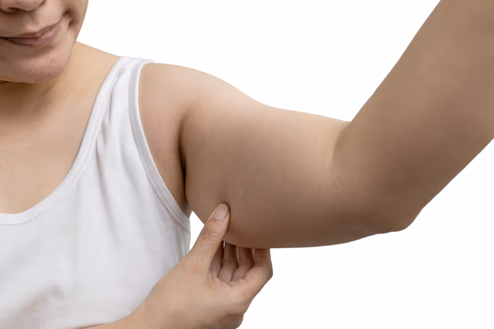 coolsculpting arm