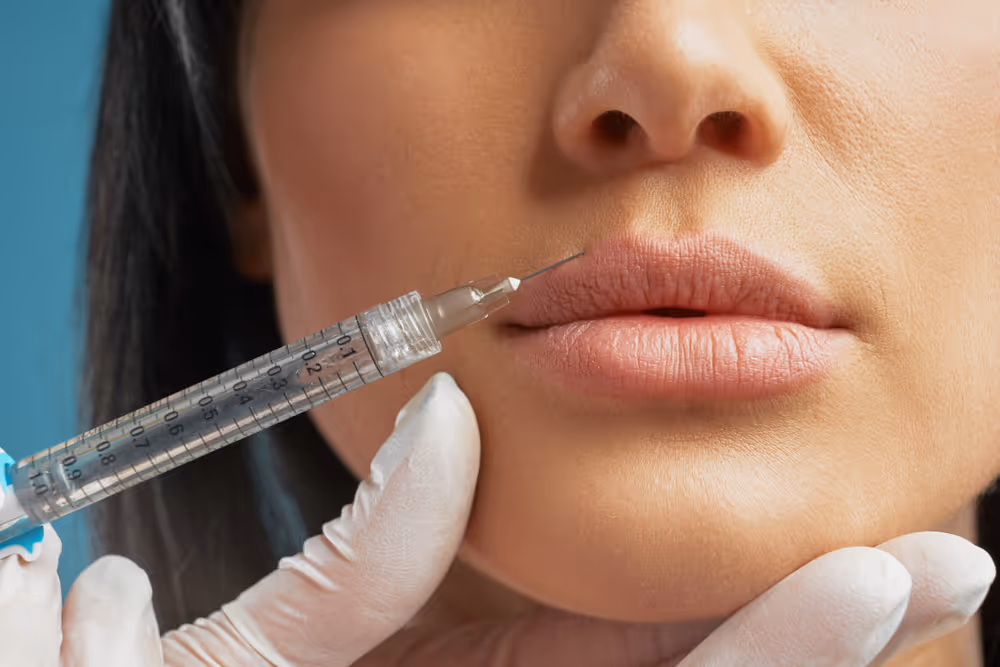 lip flip botox toronto