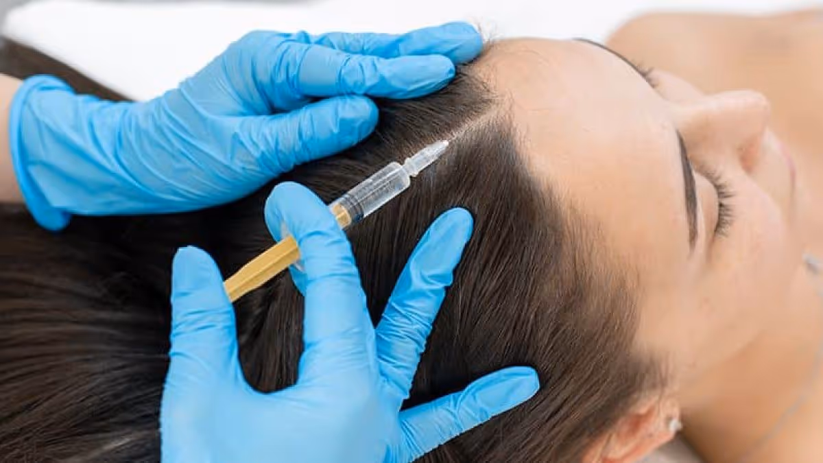prp hair restoration in richmond hill