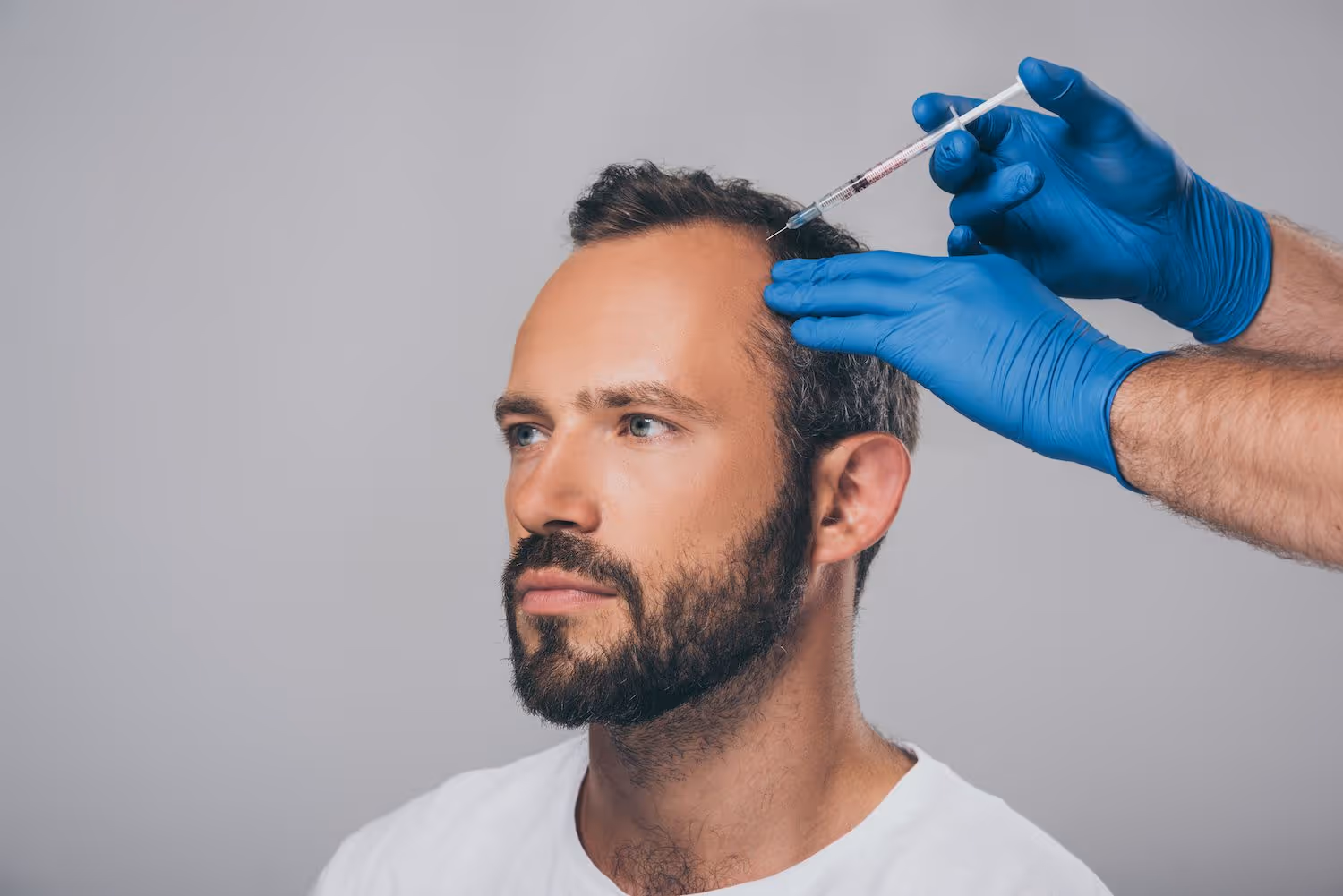 prp hair restoration in oakville
