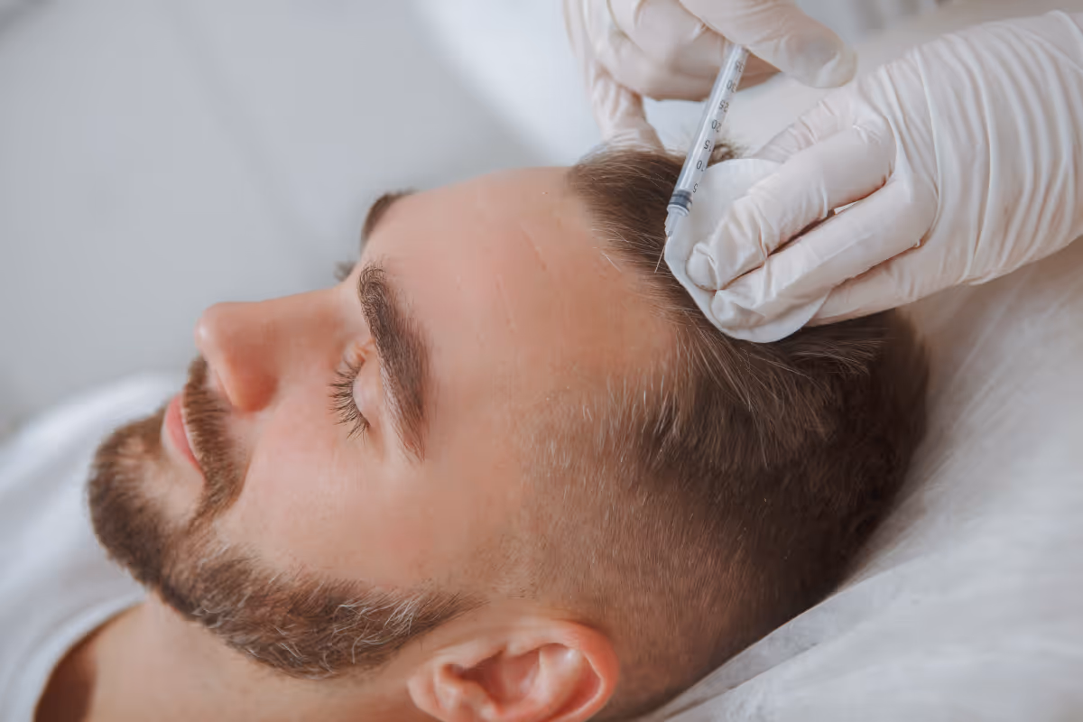 prp hair restoration in brampton