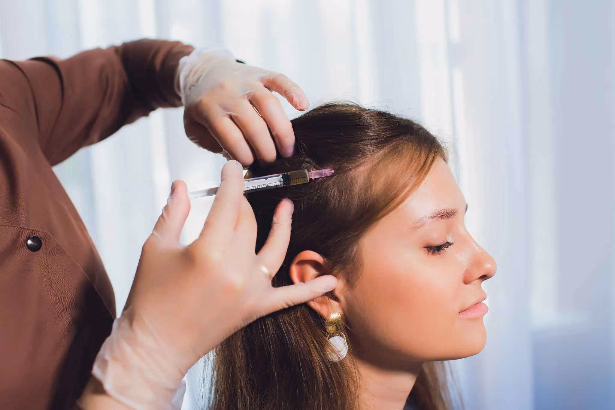 prp hair restoration