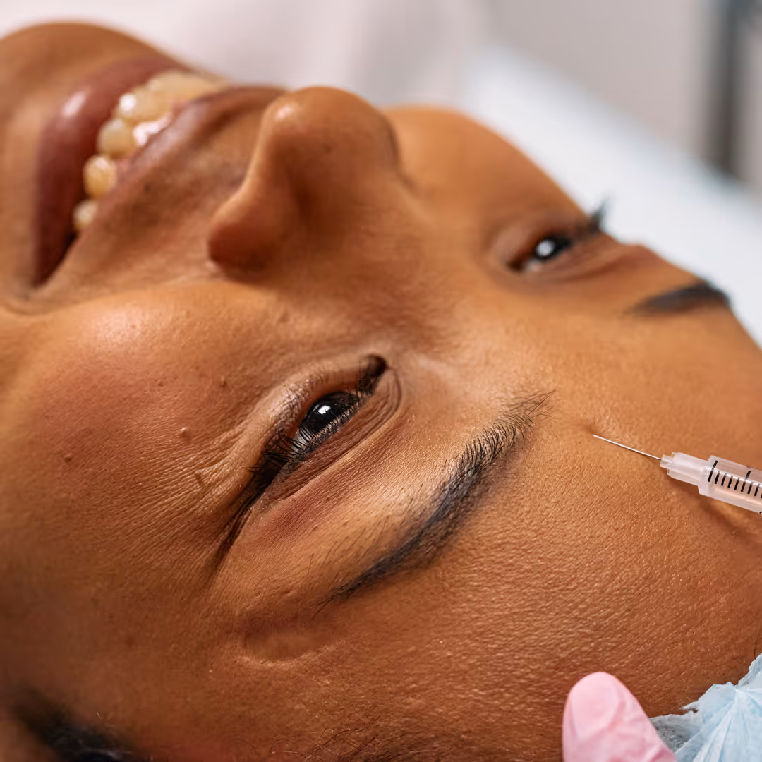 botox for forehead line toronto