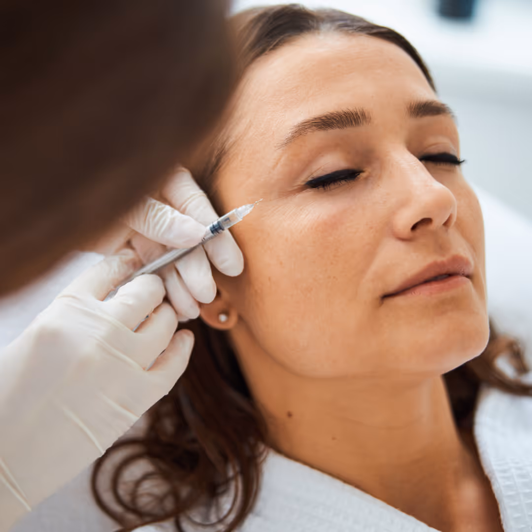 botox for crows feet toronto
