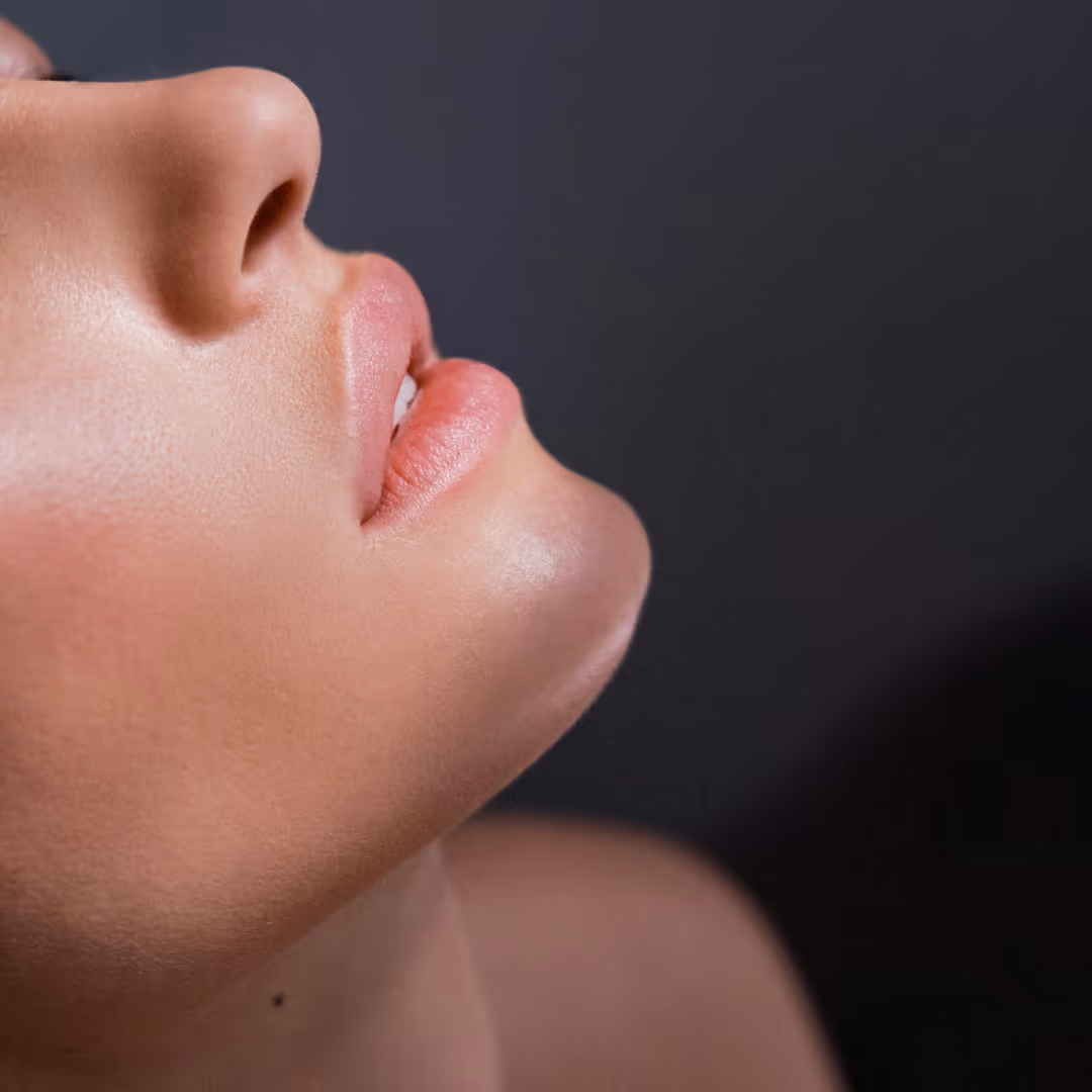 botox for lip lines