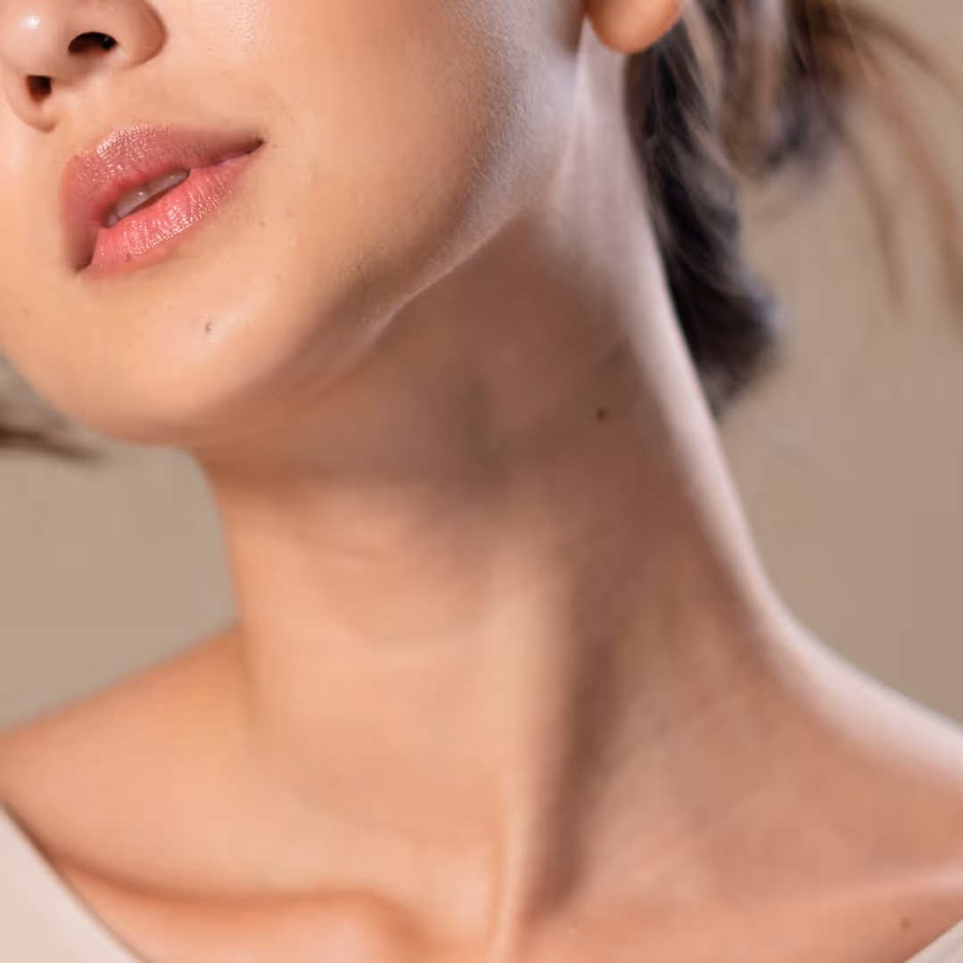 ultherapy toronto