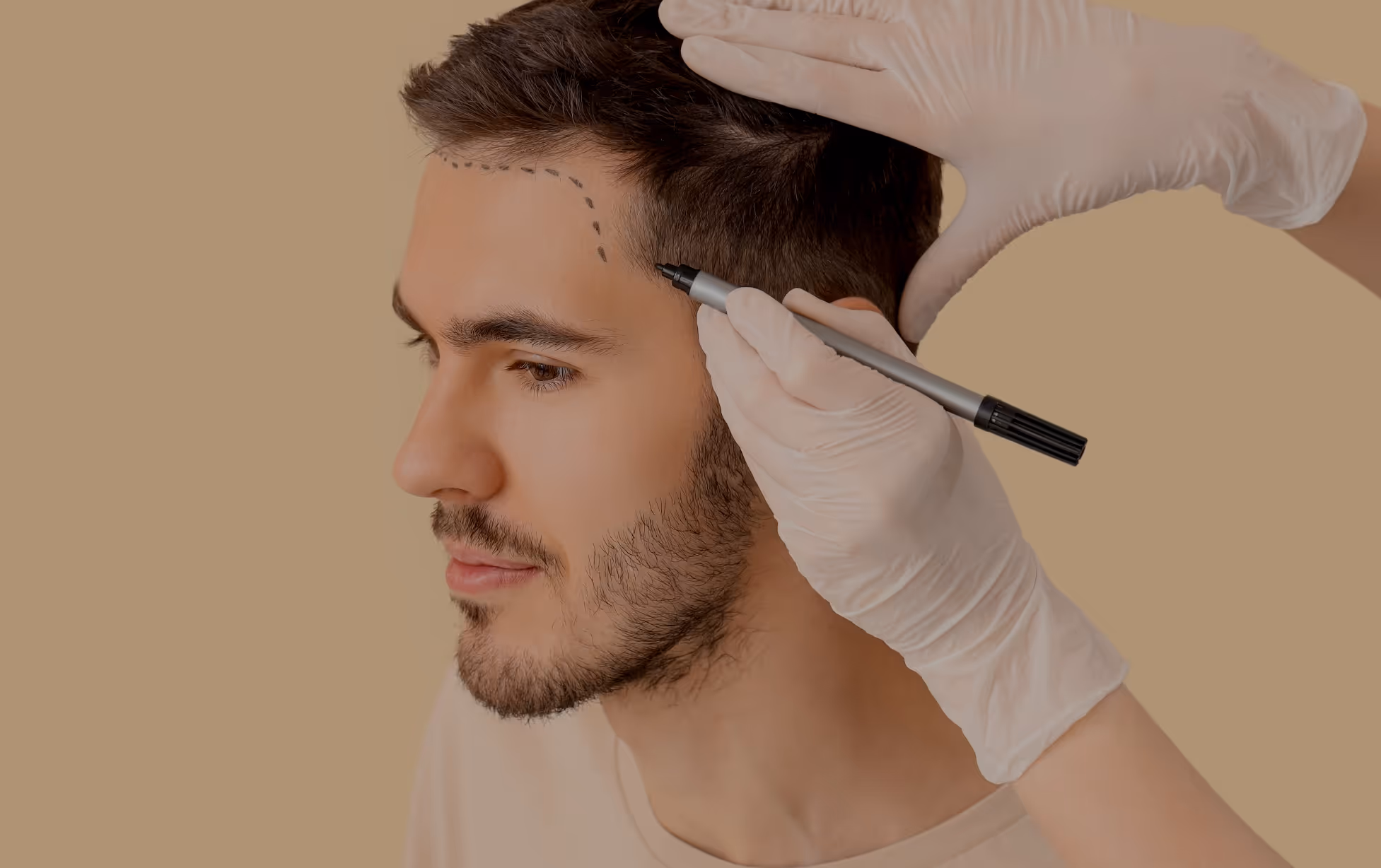 hair transplant in scarborough