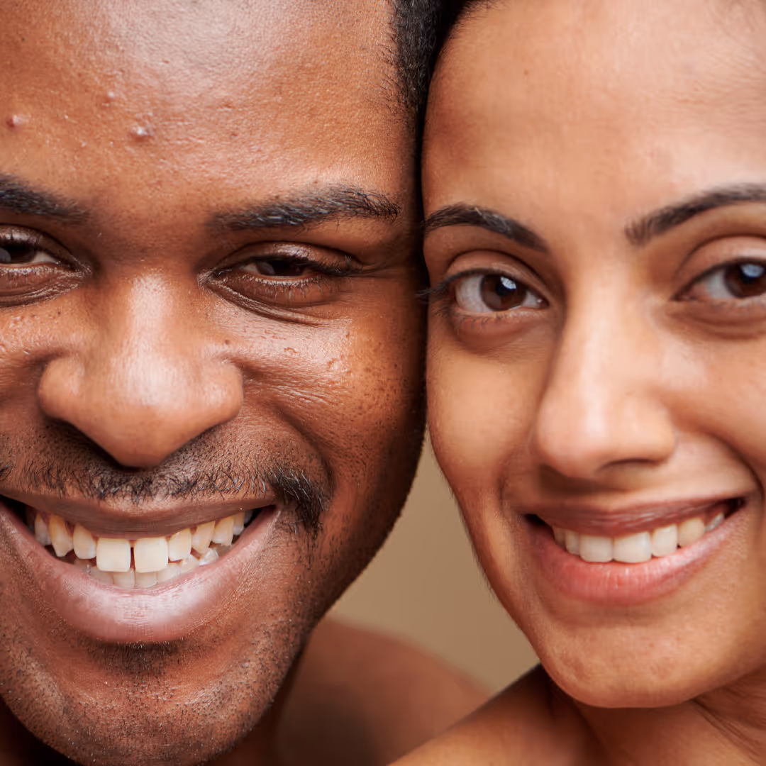 crows feet botox for men