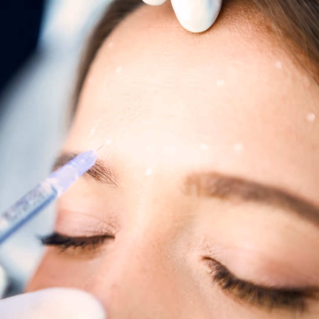 botox for frown line toronto