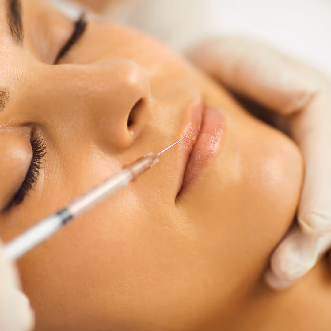 botox for lip line toronto