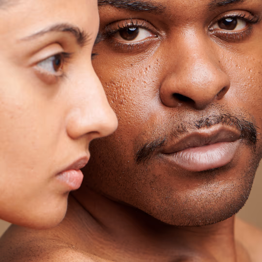 lip lines botox for men