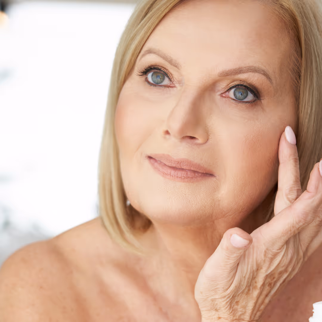 botox for crows feet