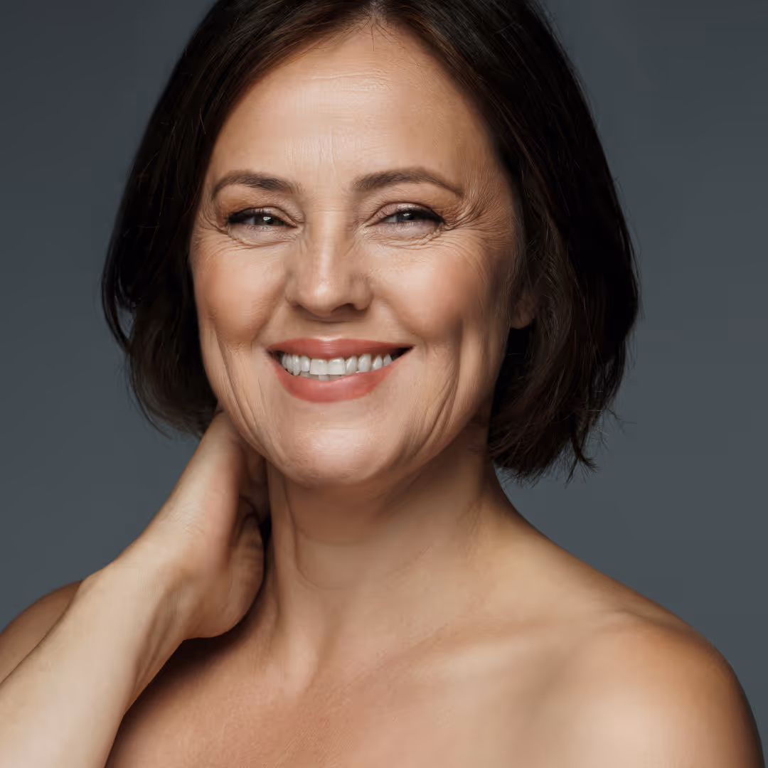 dermal fillers for marionette lines toronto