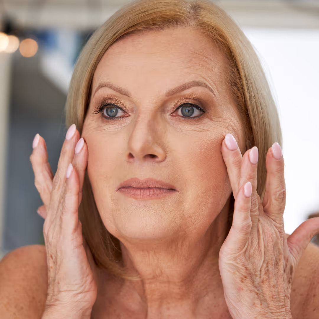 marionette lines dermal filler toronto