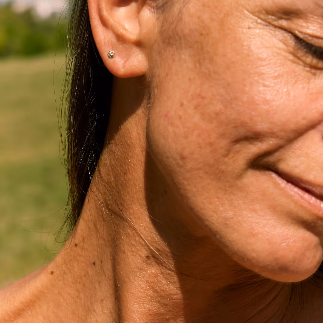 botox in brampton