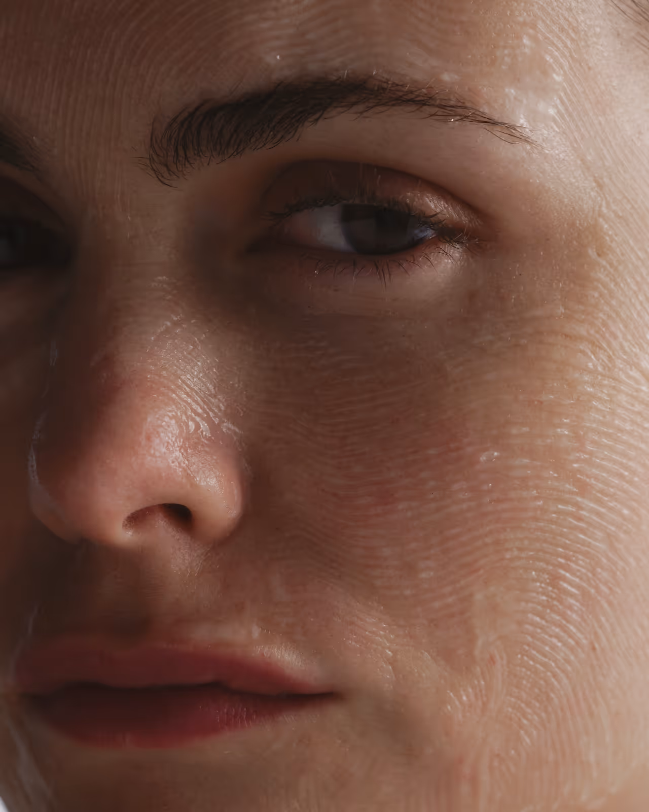 dermal fillers for under eye toronto