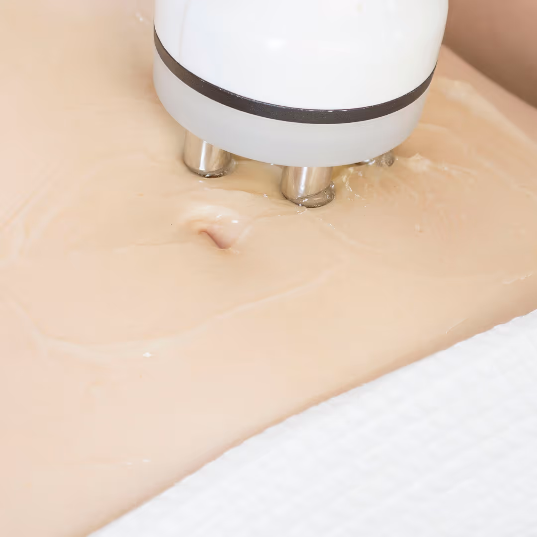 venus legacy procedure