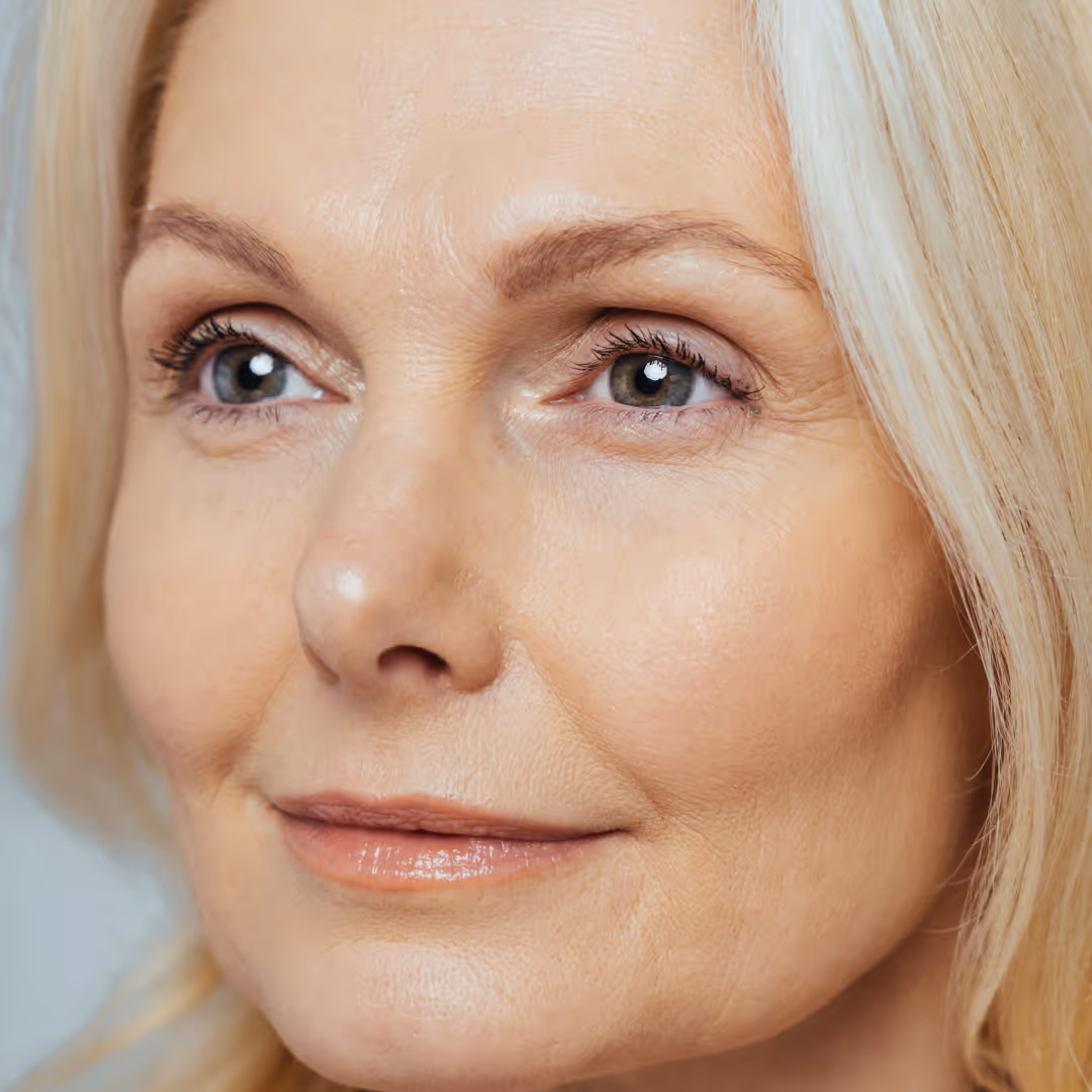 botox in brampton