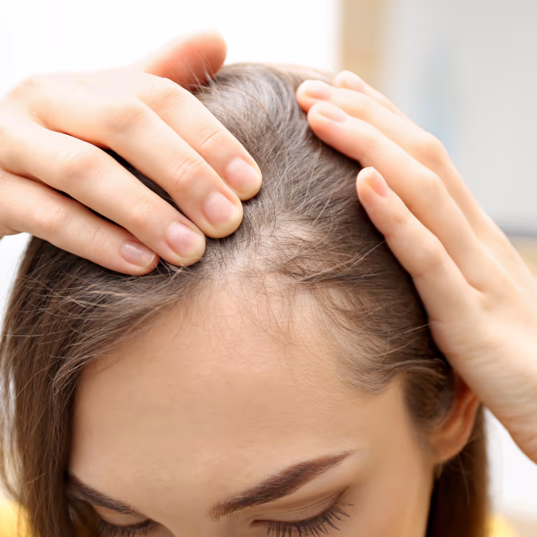 female hair transplant treatment