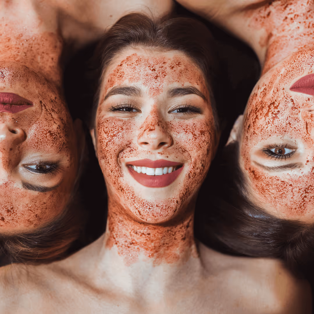 bbl photofacial treatment toronto