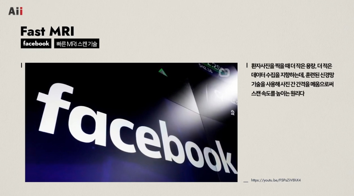 AI를 활용한 빠른 MRI 스캔 기술